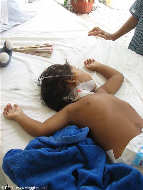 Child lying on a bed with neck bandage and nasal feeding tube
