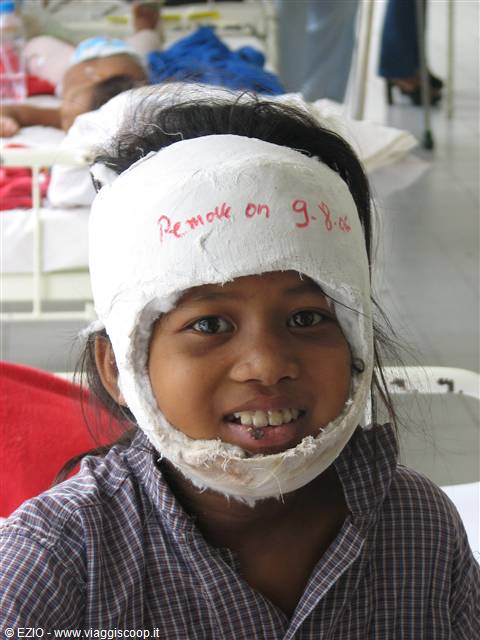 Smiling girl wearing a plaster bandage on her head, in a hospital