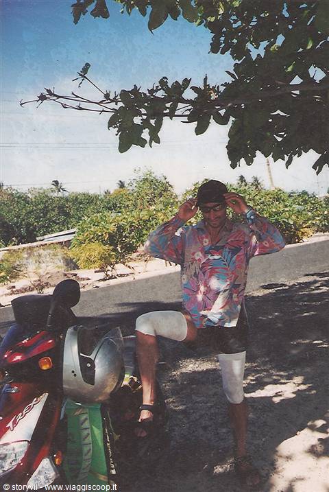man with leg bandage beside a red scooter under a tree