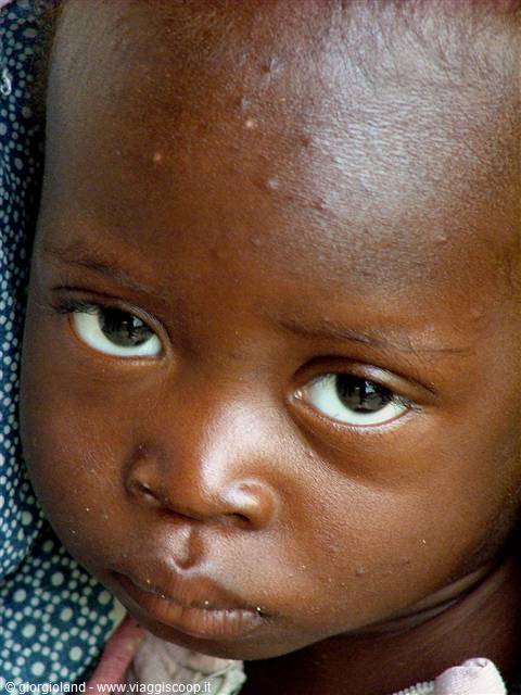 Close-up portrait of a child with intense eyes, blue dotted fabric behind